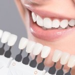 Beautiful smile and white teeth of a young woman. Matching the shades of the implants or the process of teeth whitening.