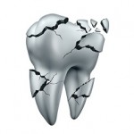 Broken tooth dental symbol and toothache dentistry concept as a single cracked damaged molar on an isolated white background.